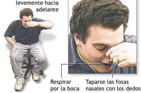 Tip list epistaxis 2