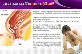 Tip list hemorroides 2