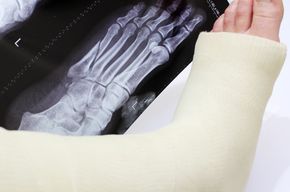 Tip list fractura