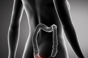 Tip list 123 hemorroides mujer