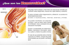 Tip list hemorroides 2