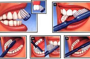 Tip list di ler nas l f r alan r