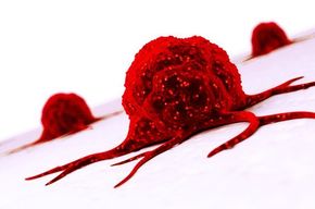 Tip list 123 tumor