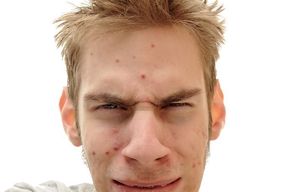 Tip list acne