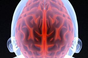 Tip list cerebro 3