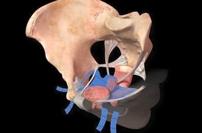 Tip list cirugia minima invasion