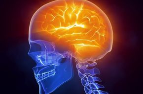 Tip list cerebro