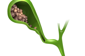 Tip list vesicula copia
